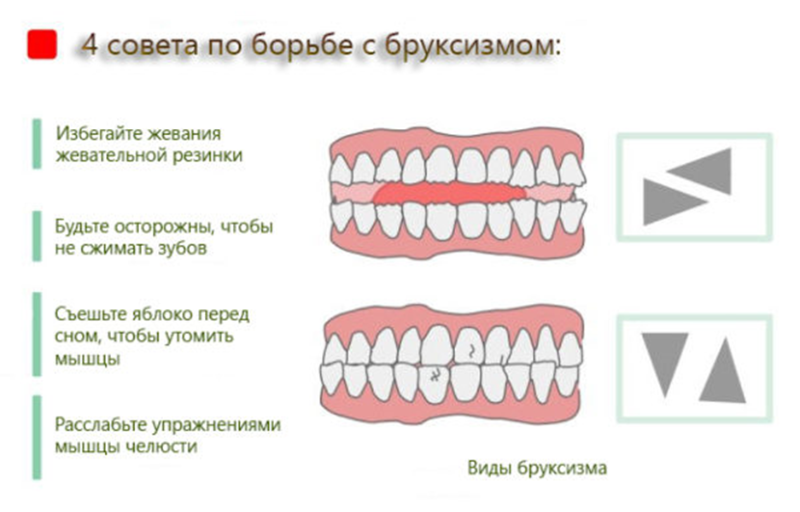 бруксизм у дітей